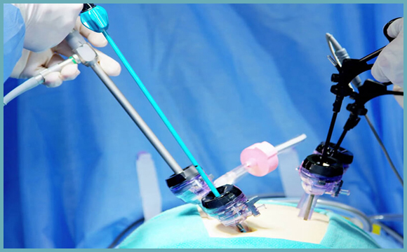 laparoscopic_surgery