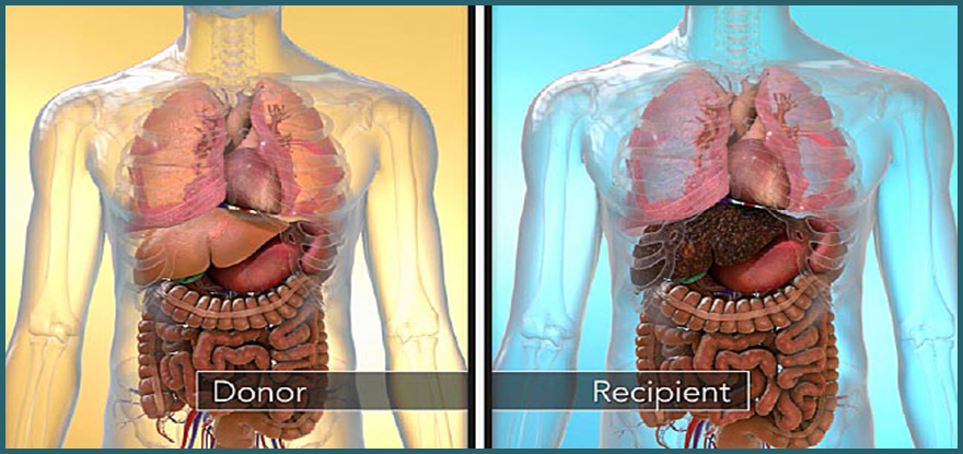 liver_transplantation